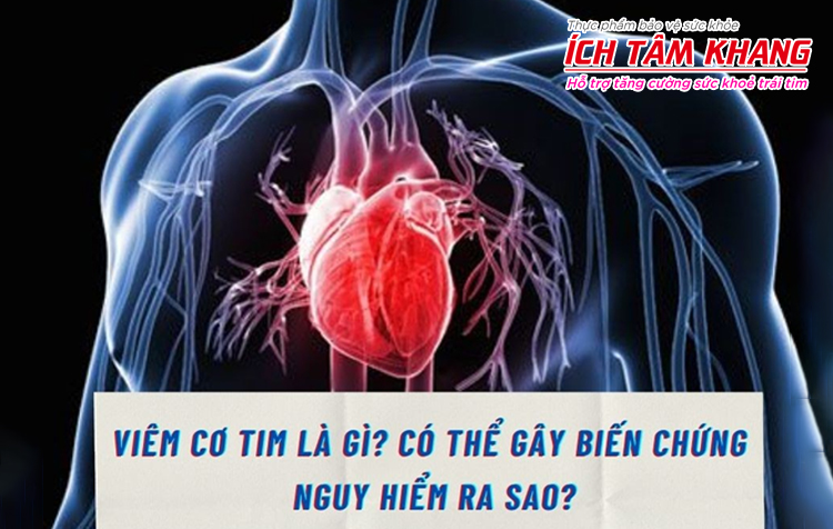 Nắm rõ thông tin về viêm cơ tim sẽ giúp bạn điều trị bệnh tốt nhất
